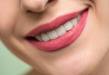 Invisalign : combien débourser pour ce traitement ? sourire dents femme